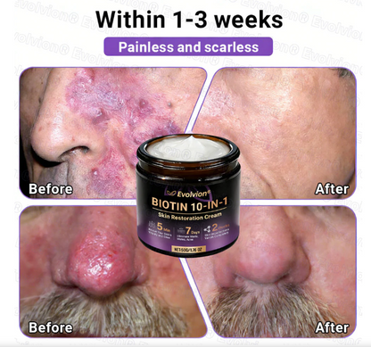 Biotin 10 in 1 Skin Restoration cream(pack of 2)