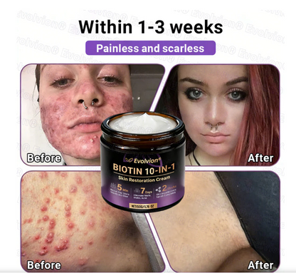 Biotin 10 in 1 Skin Restoration cream(pack of 2)